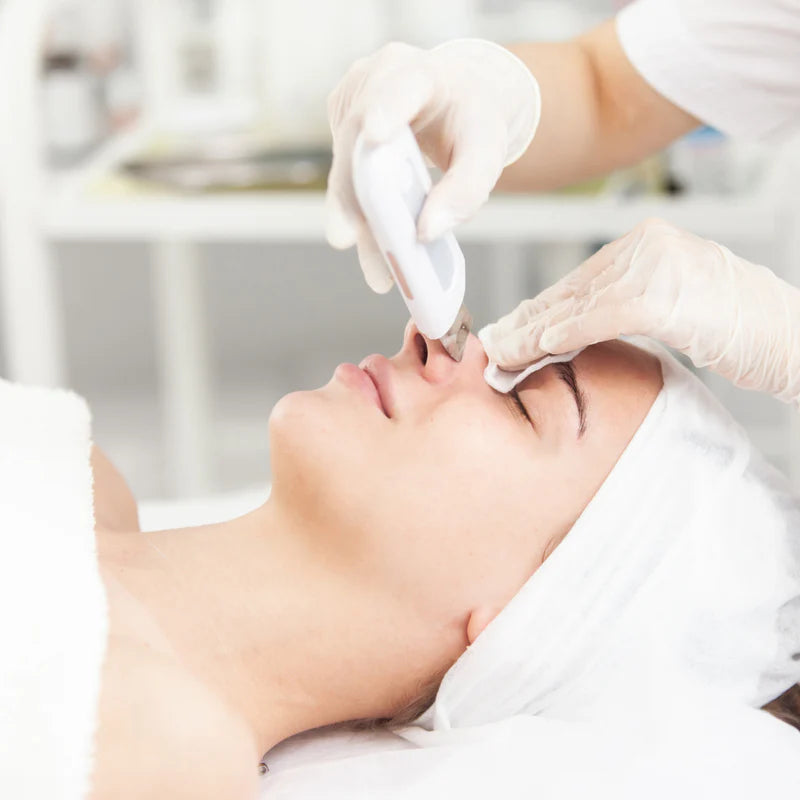 Limpiador Peeling Facial Ultrasónico